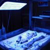 دستگاه فتوتراپی | نی‌نی یلو