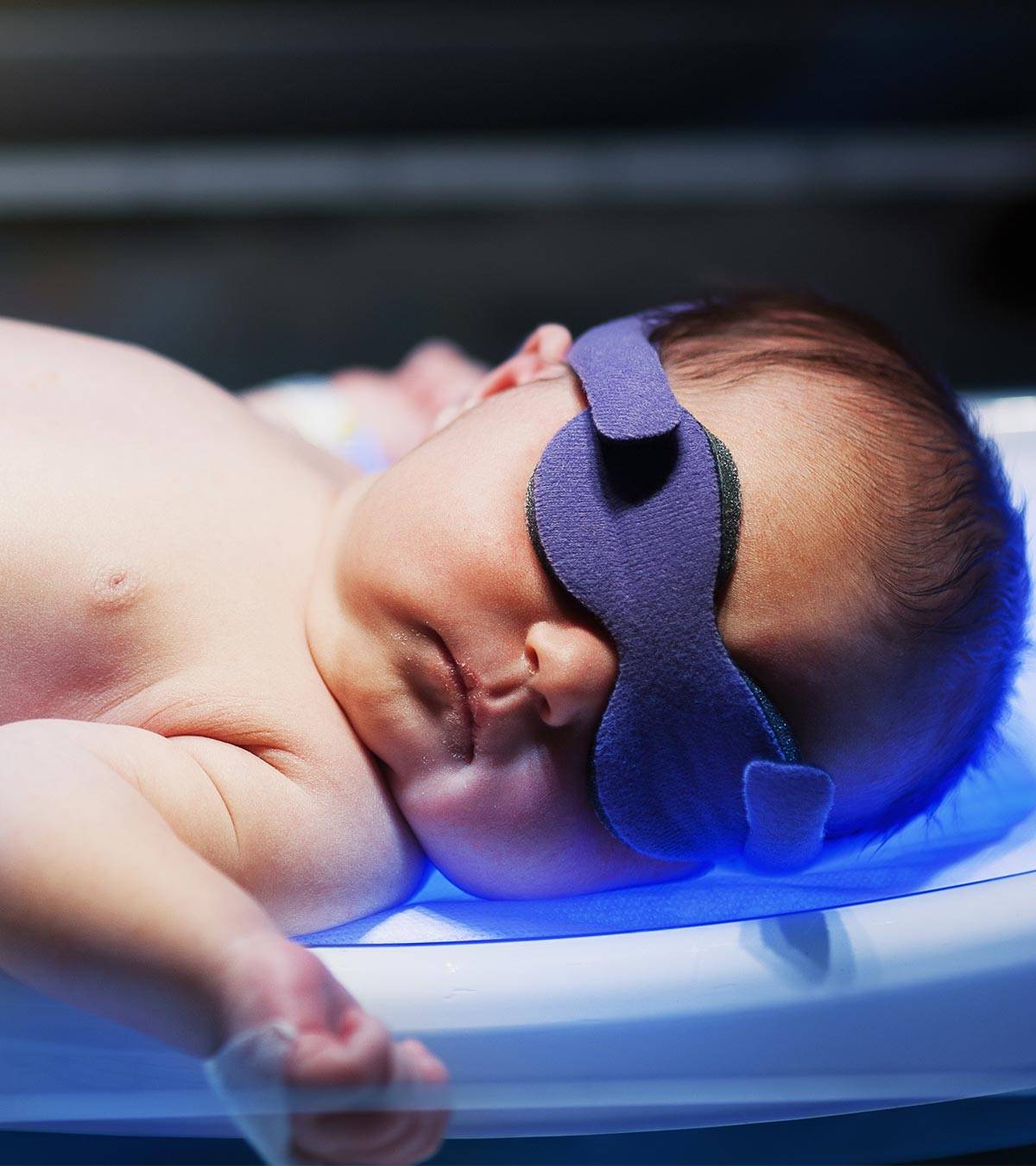 نوزادی پس از اجاره دستگاه زردی نوزاد در حال فتوتراپی