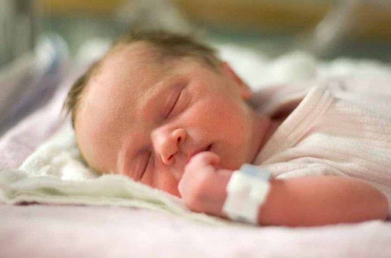 بررسی دقیق زردی نوزاد | نی‌نی یلو