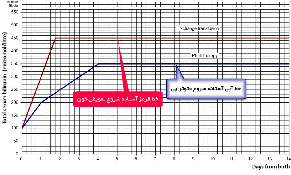 گراف آستانه درمان زردی نوزاد