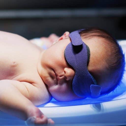 نوزادی پس از اجاره دستگاه زردی نوزاد در حال فتوتراپی